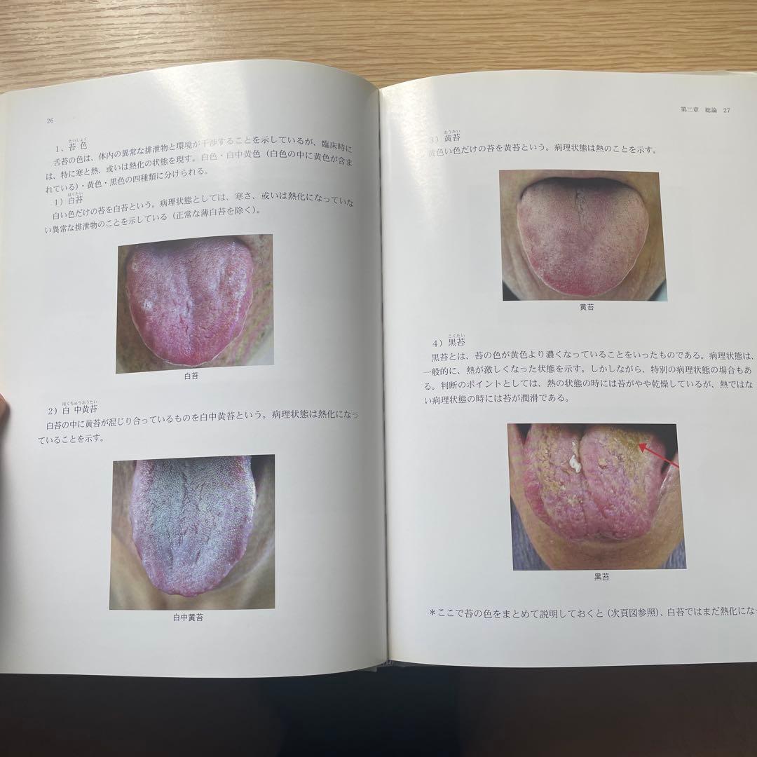 舌診論