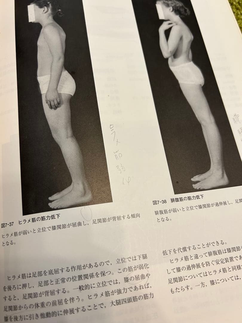 筋:機能とテスト : 姿勢と痛み　ケンダル