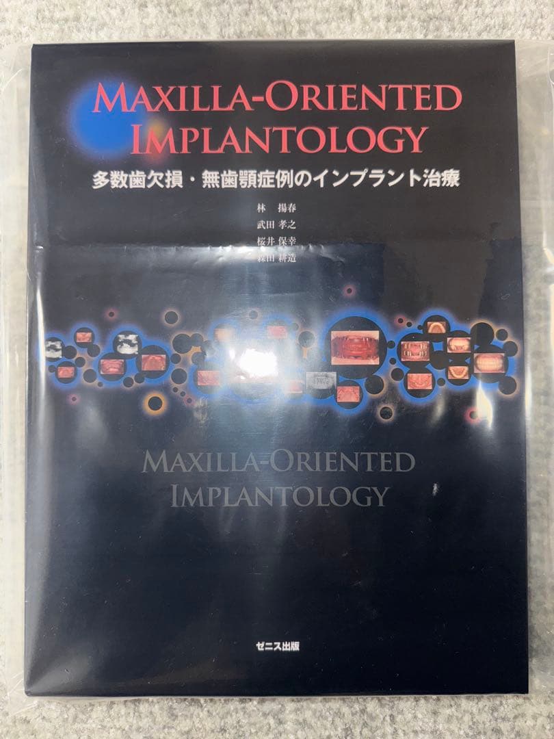 【裁断済み】多数歯欠損・無歯顎症例のインプラント治療