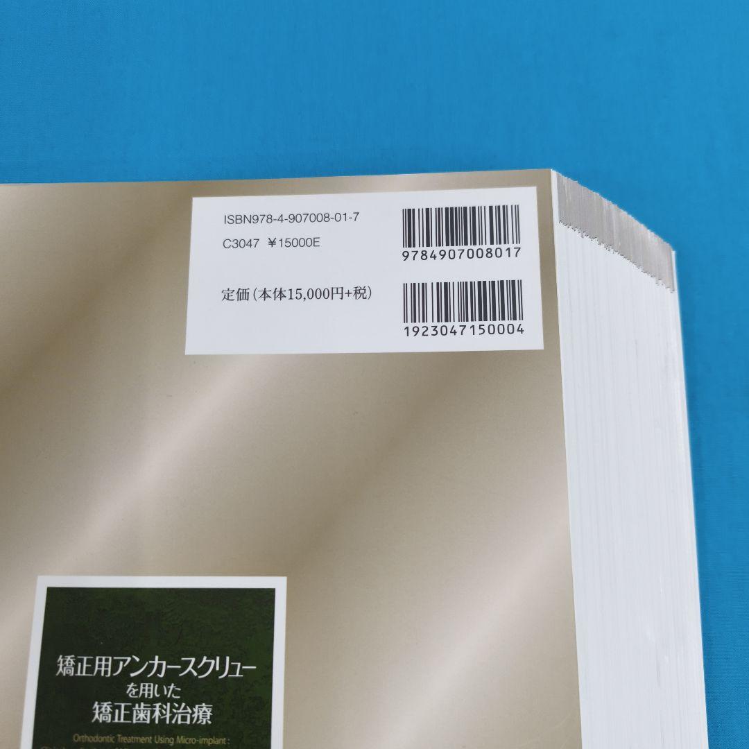 #裁断済 矯正用アンカークリューを用いた矯正歯科治療