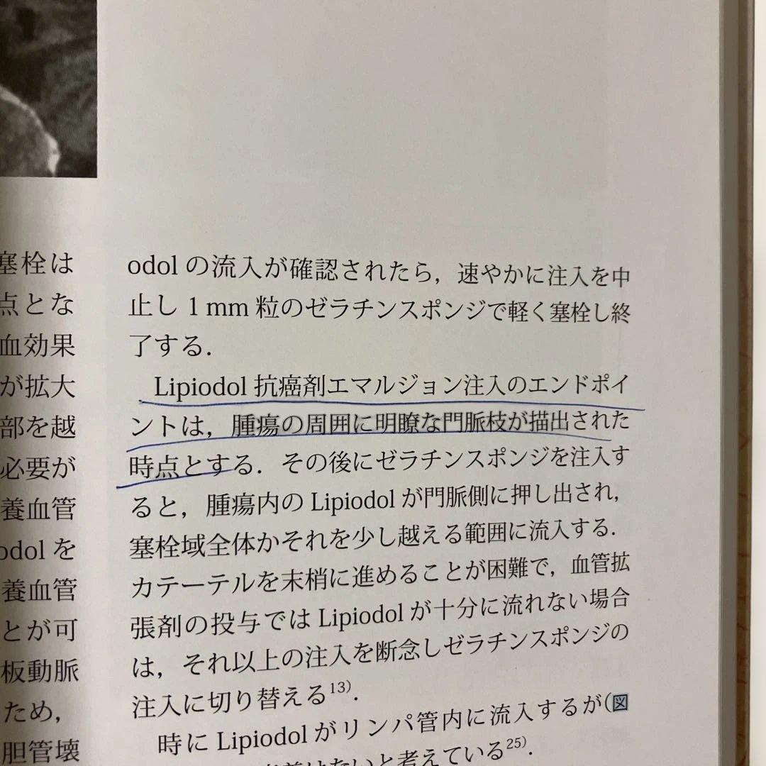 肝動脈化学塞栓法 (TACE) 理論と実践ストラテジー