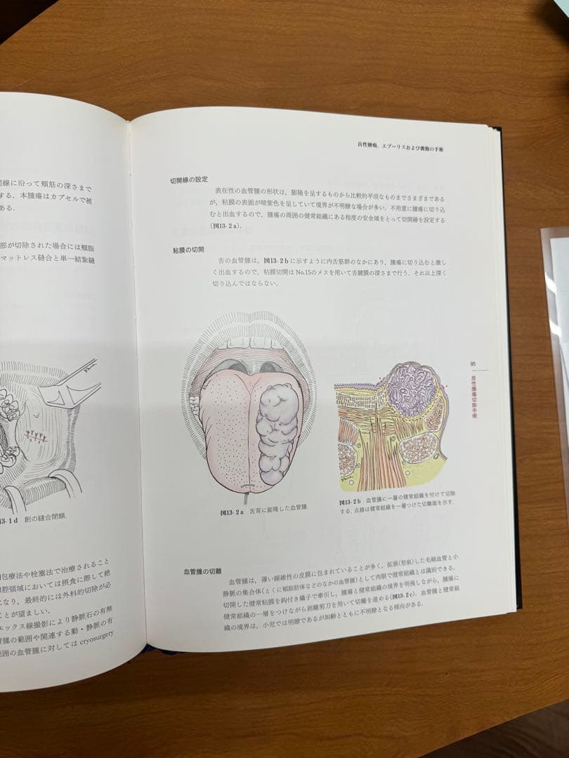 イラストでみる口腔外科手術　第二巻