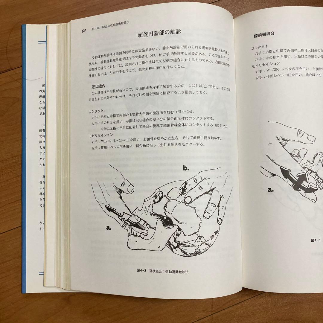 頭蓋縫合