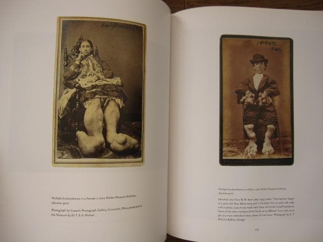 Mutter Museum： Of the College