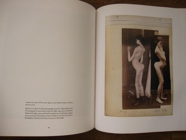 Mutter Museum： Of the College