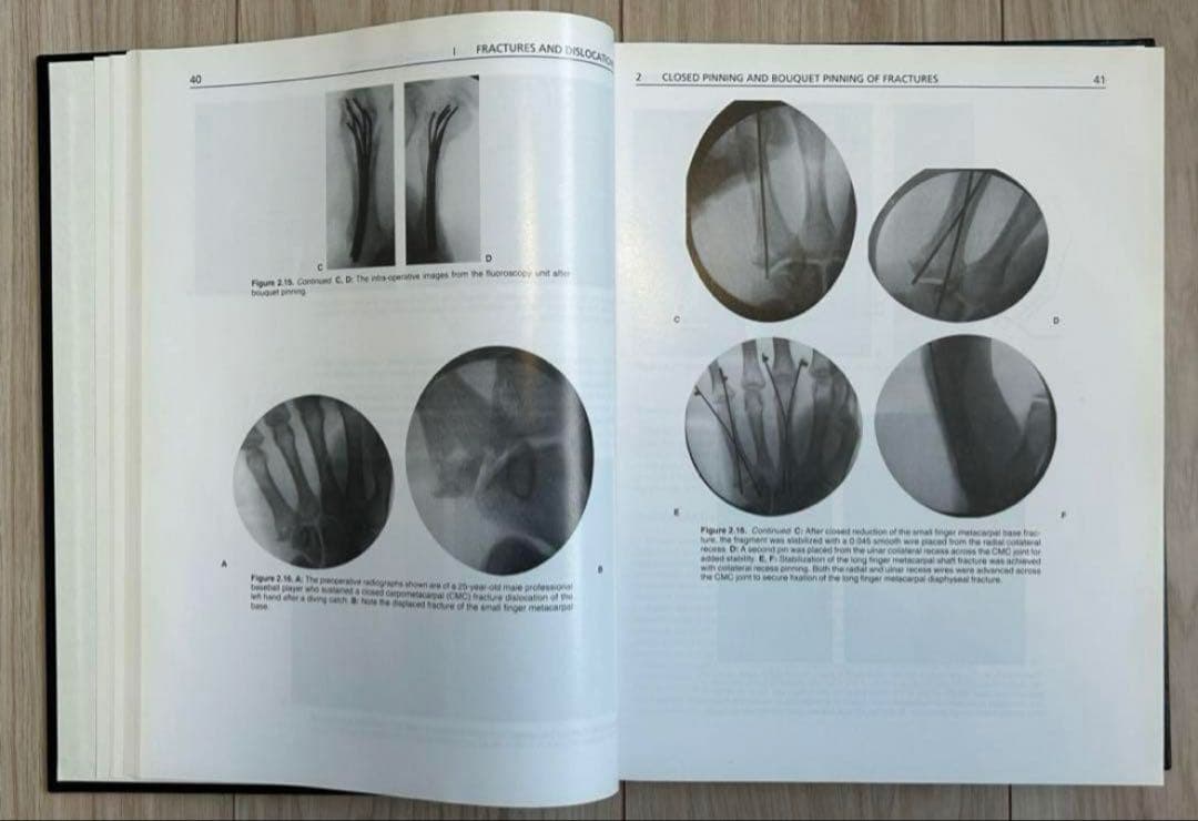 THE HAND Second Edition 医学書　洋書　外科