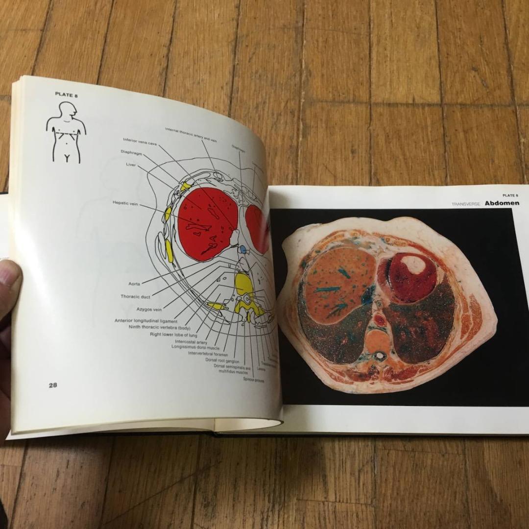 A color atlas of sectional anatomy医学洋書大型