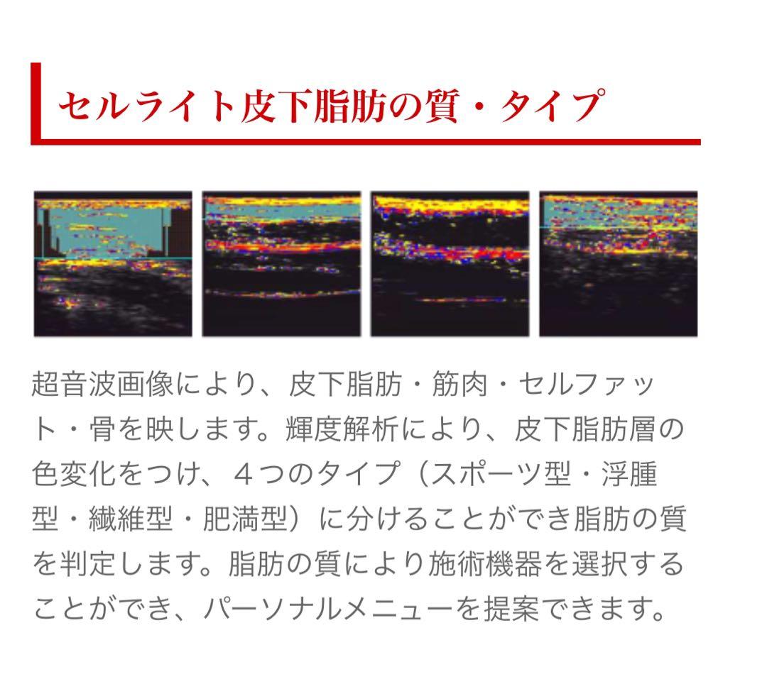 【最終値下げ】BFIメジャー　体組成計　ノートパソコンセット　インボディ
